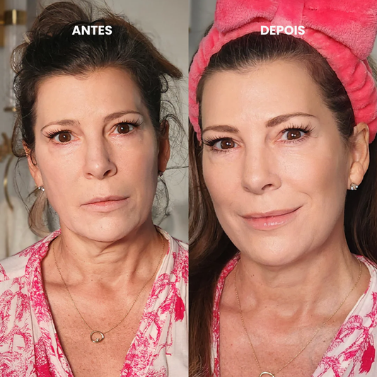 Massageador Facial Revitalisse